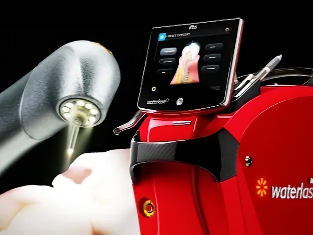 Laserul dentar Erbium YAG Waterlase